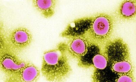 ما هي أعراض الفيروس التاجي لدى البشر؟