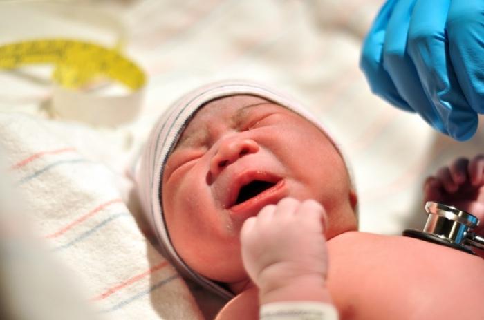 النزف في دماغ المولود الجديد: الأسباب والعواقب