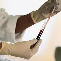 معيار اختبار الدم، ما هو أهميته